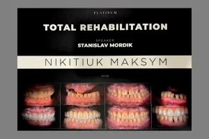 maksym-nikitiuk-06