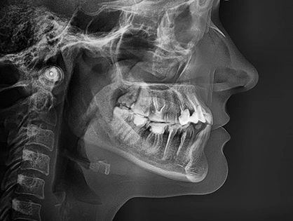 лікування у ортодонта