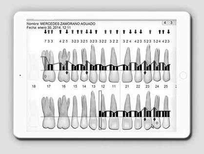 Лечение десен