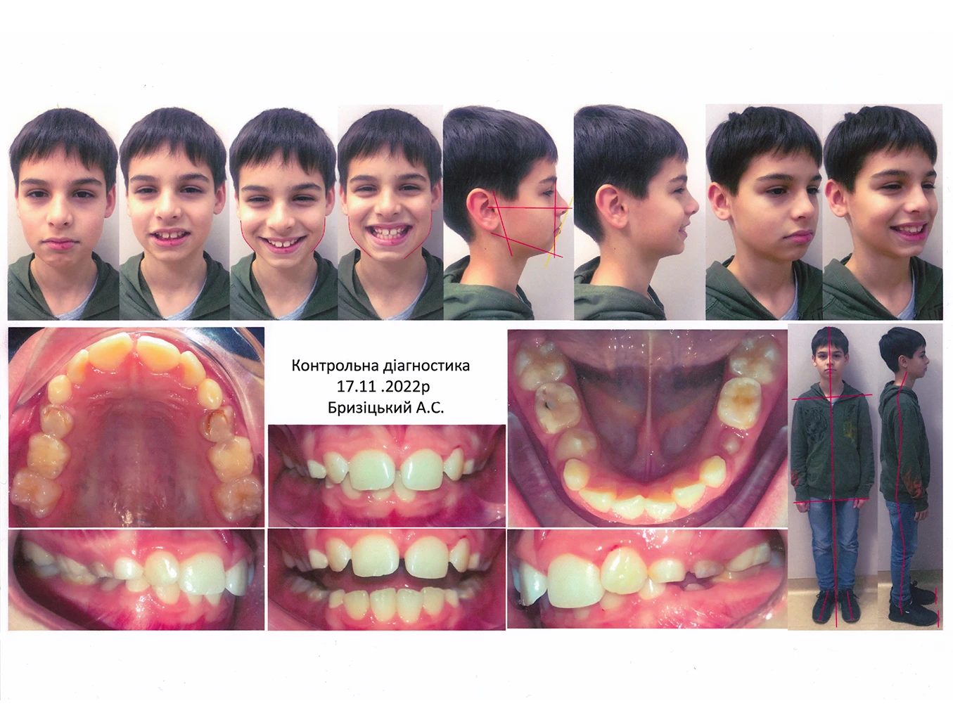 Фотопротокол у стоматології Фотопротокол у стоматології