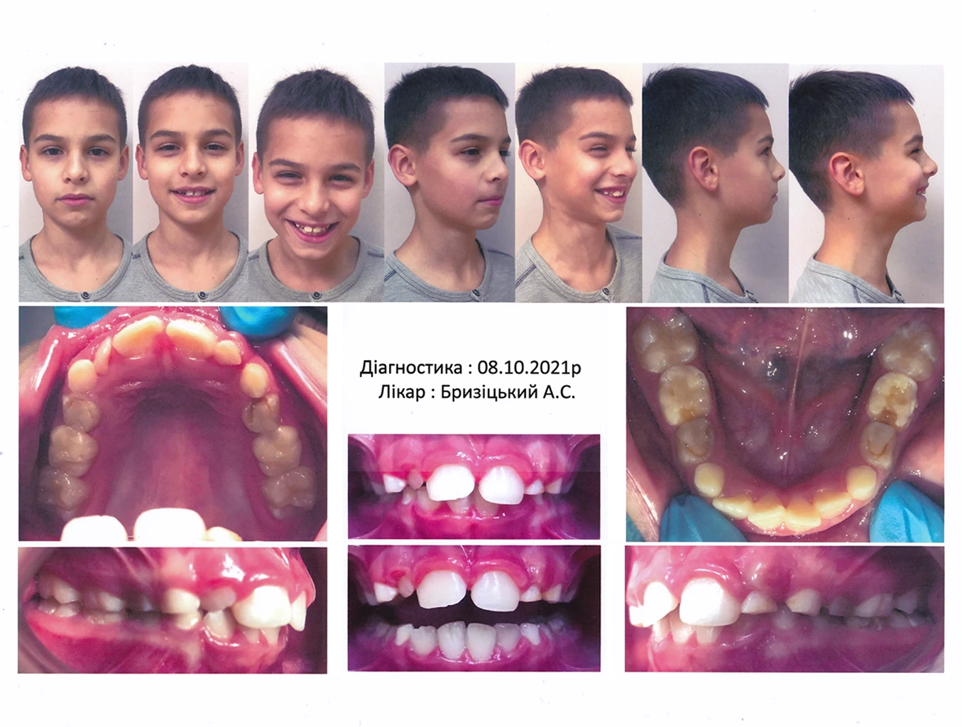 Фотопротокол у стоматології Фотопротокол у стоматології