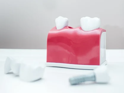 Лікування пародонтиту. Причини, симптоми, діагностика