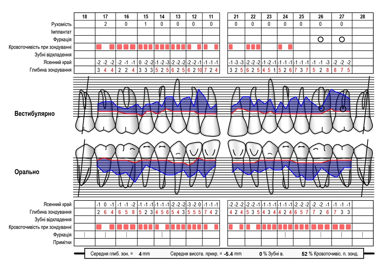 Пародонтологічна карта Пародонтологічна карта