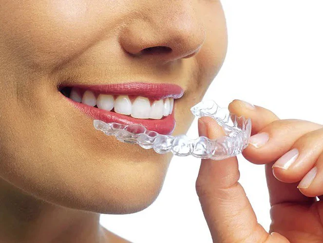 Корекція прикусу